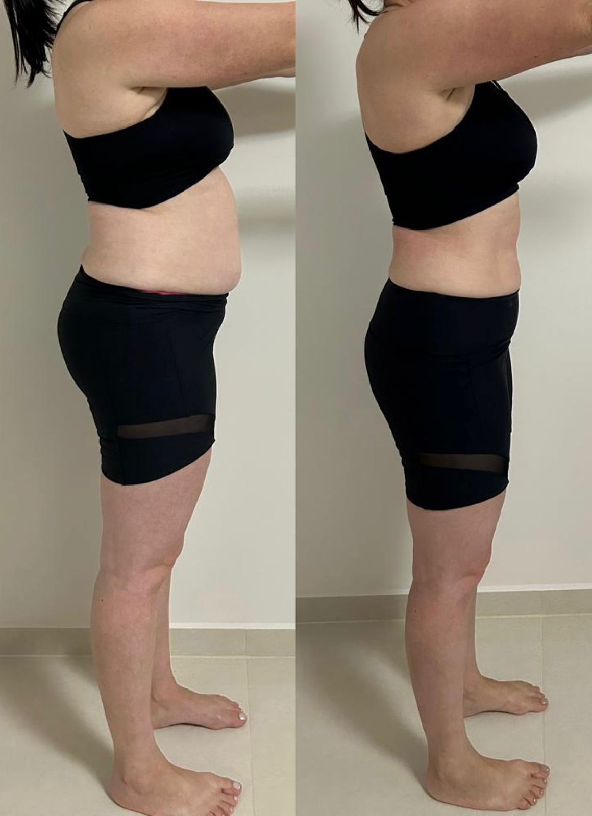 Antes e depois 4