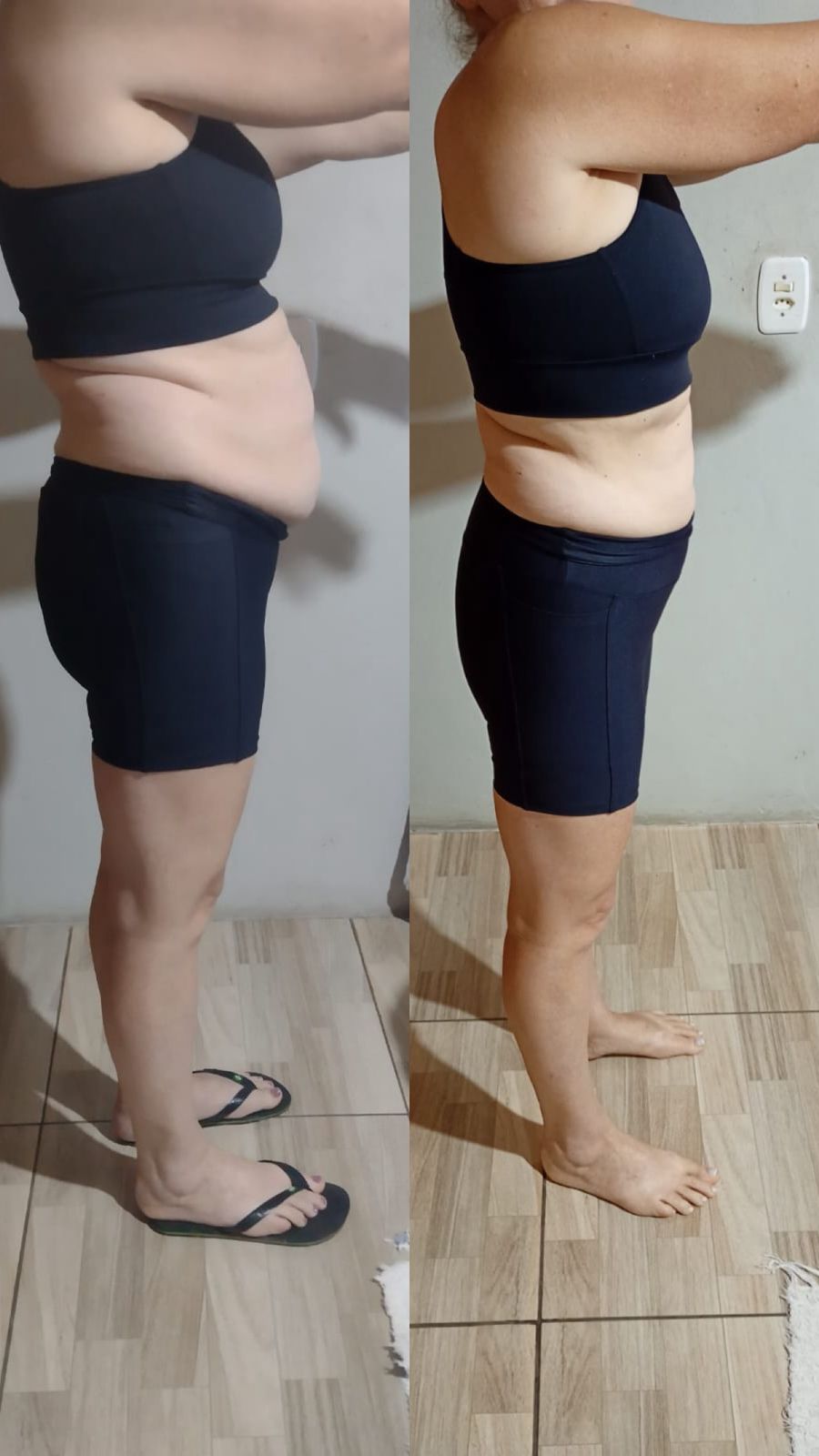 Antes e depois 5