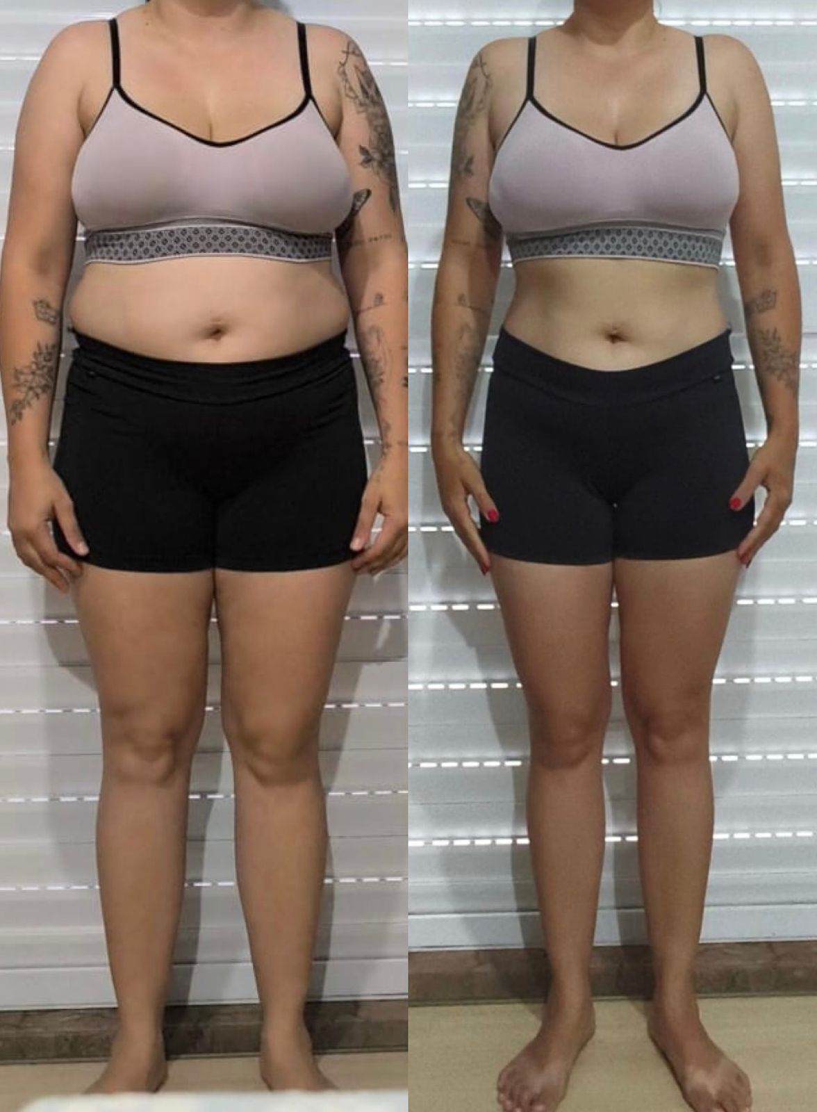 Antes e depois 2