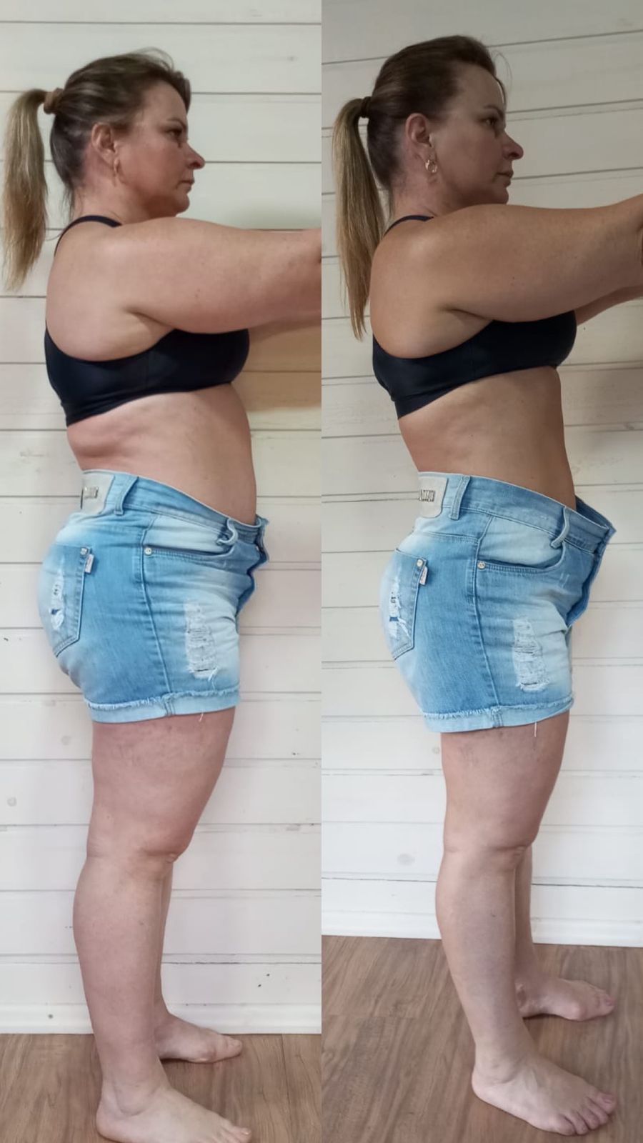 Antes e depois 1