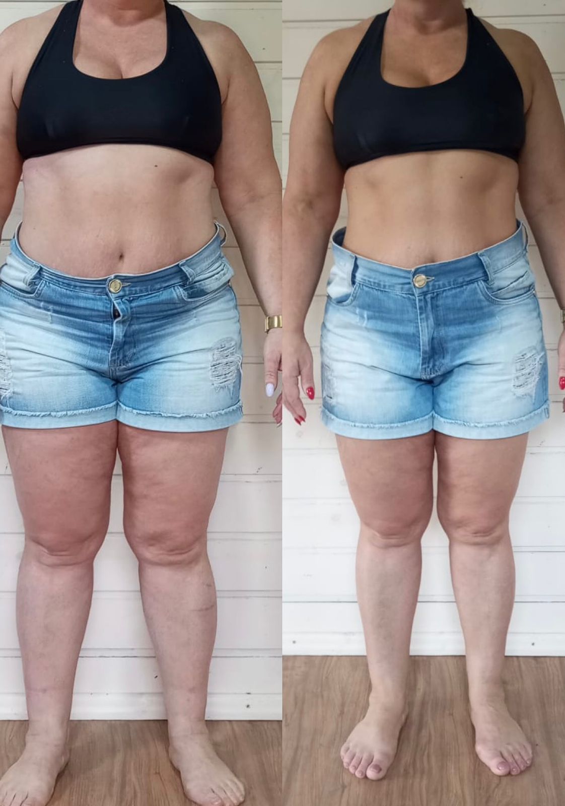 Antes e depois 3